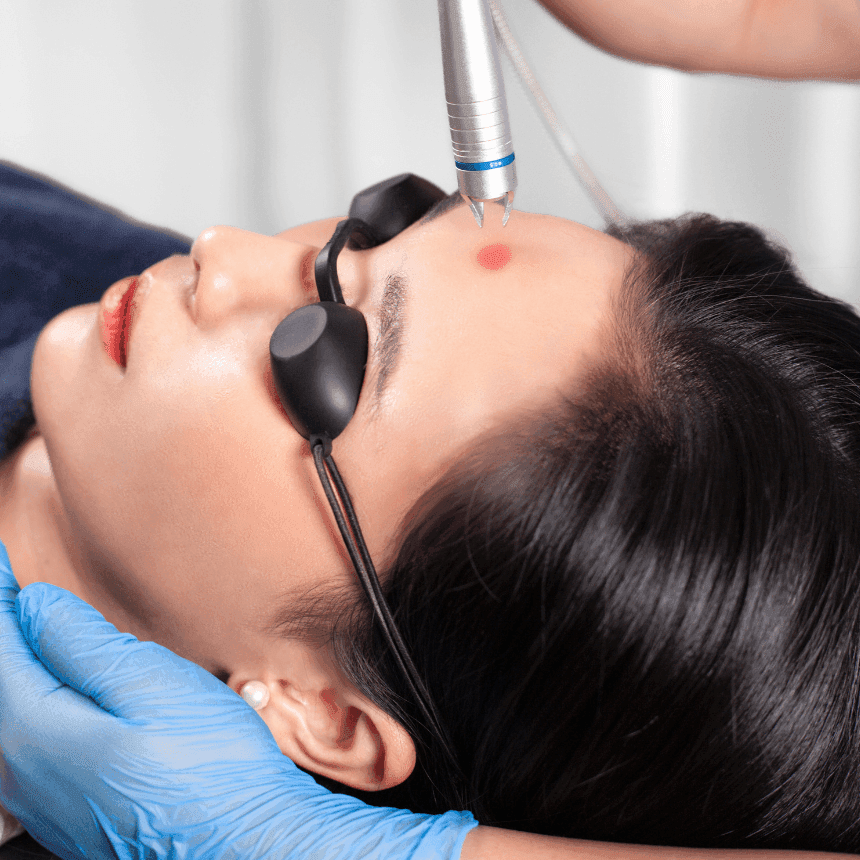 Korean Glass Skin Laser