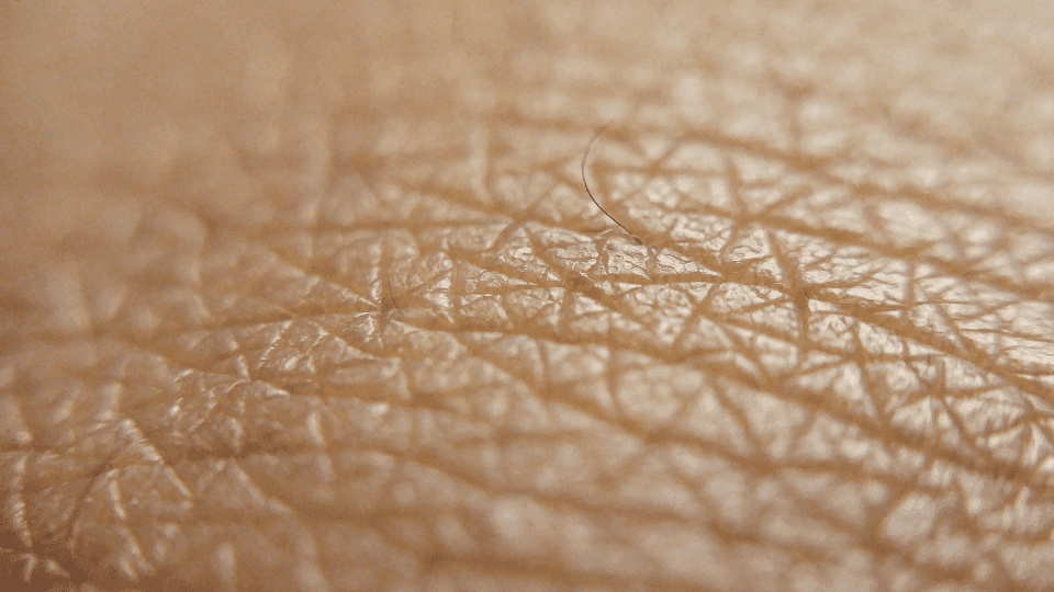 Kulit Kering atau Dehidrasi Saat Puasa? Kenali Bedanya & Solusinya