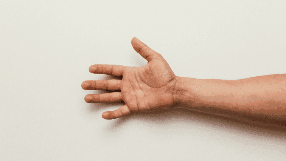 Kulit Tangan Mengelupas? Ini Penyebab dan Cara Mengatasinya