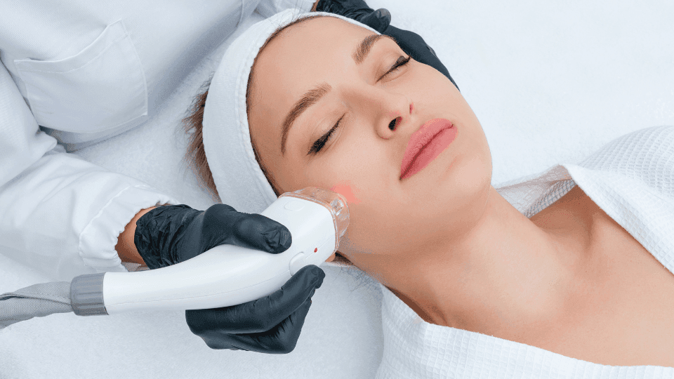 Laser Face Brightening, Prosedur Kecantikan untuk Cerahkan Wajah
