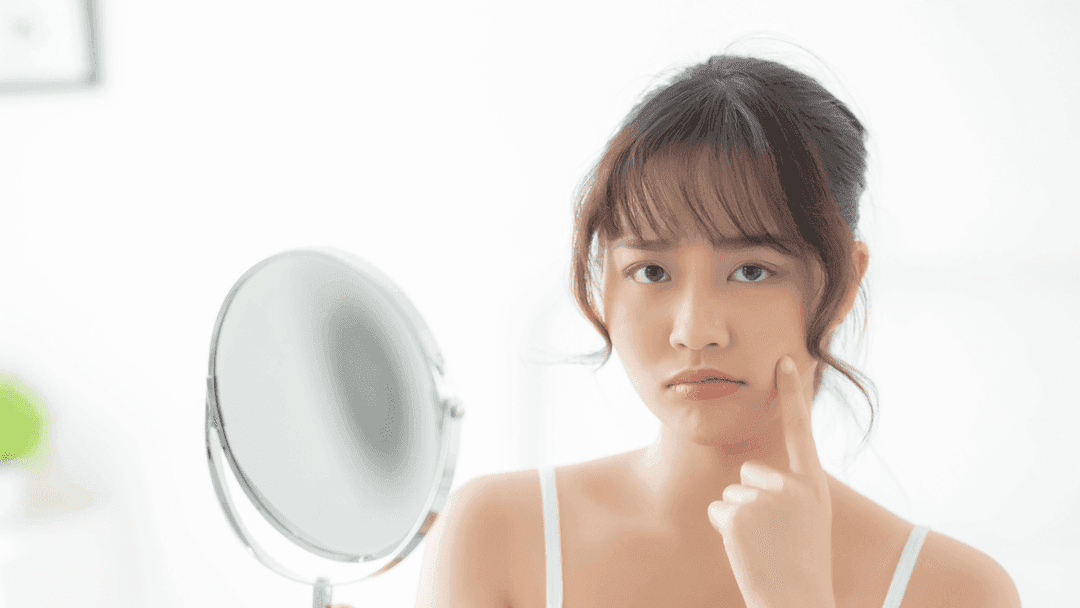 menghilangkan bruntusan di pipi