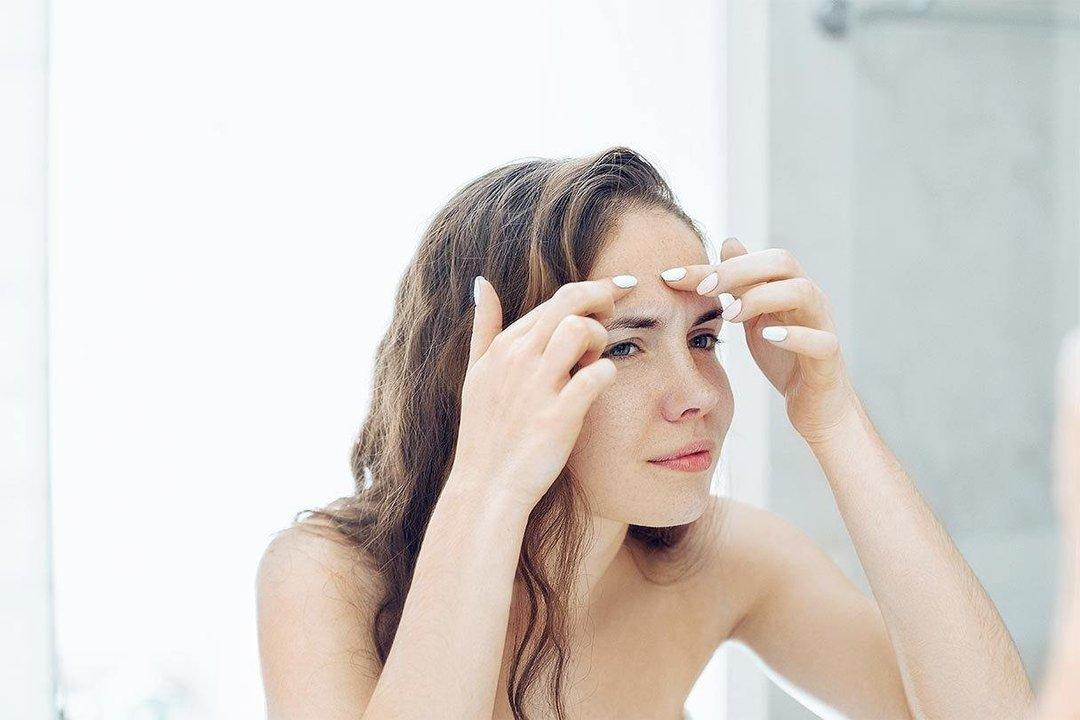 Menghilangkan Jerawat secara Alami dan Cepat