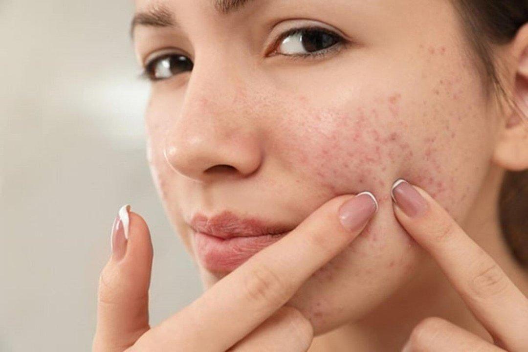 Penyebab, Ciri, dan Cara Mengatasi Skin Barrier Rusak Diricare