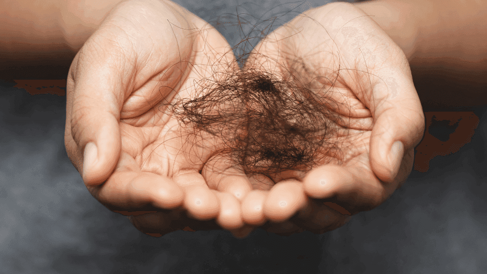 Covid 19 menyebabkan rambut rontok