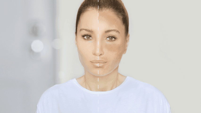 Skincare untuk Kulit Kombinasi Diricare