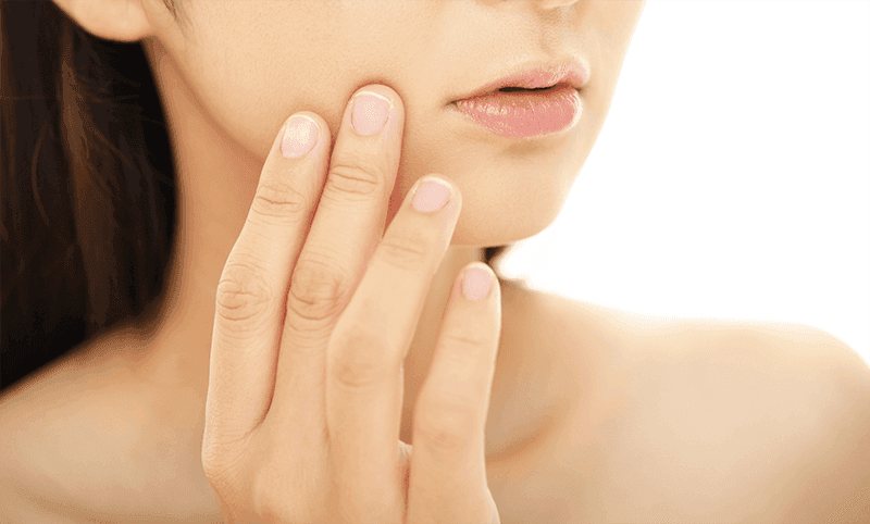 menghilangkan belang wajah