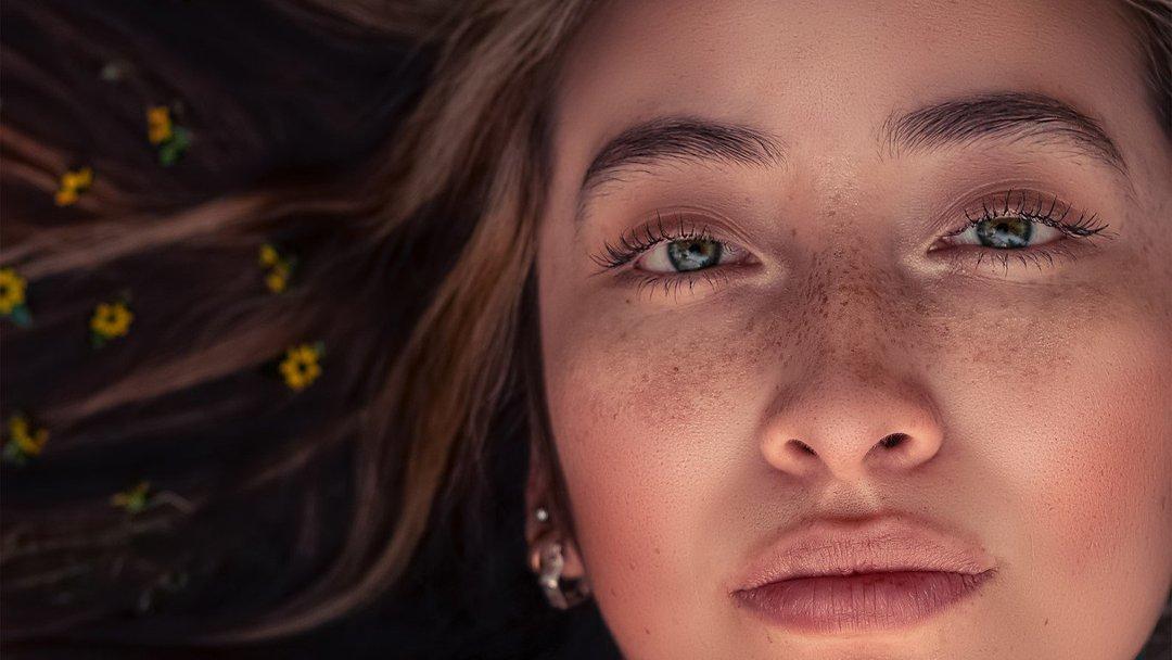 Penyebab dan Cara Menghilangkan Flek Hitam di Wajah yang Membandel Diricare