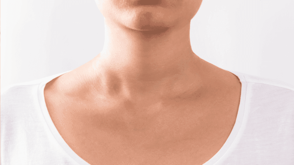 cara mengatasi jerawat di leher