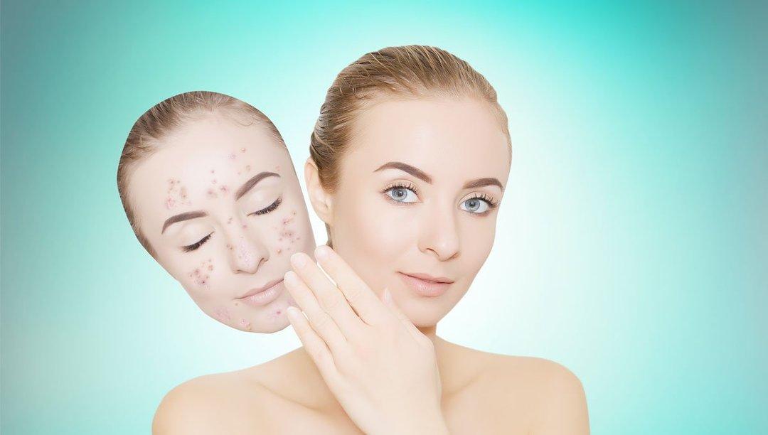 Mengatasi Wajah Bruntusan Akibat Skincare Diricare