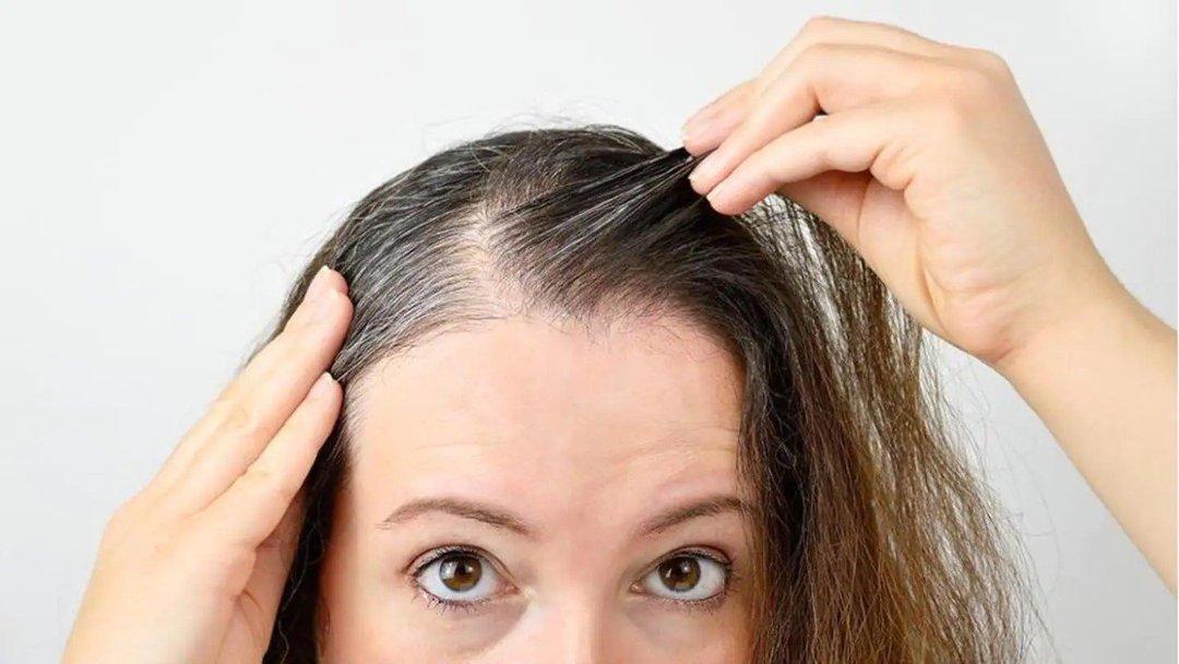 Mencegah dan Mengatasi Kebotakan Dini Diricare