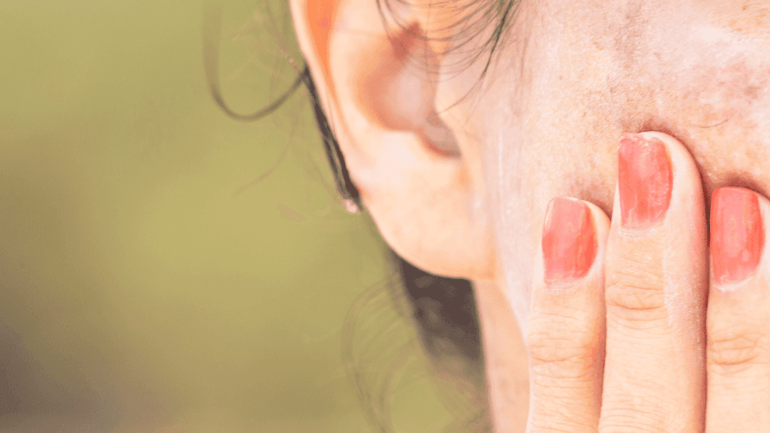 Hilangkan Flek Hitam Akibat Pil KB Diricare