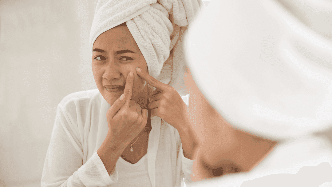 Mengatasi sebum wajah