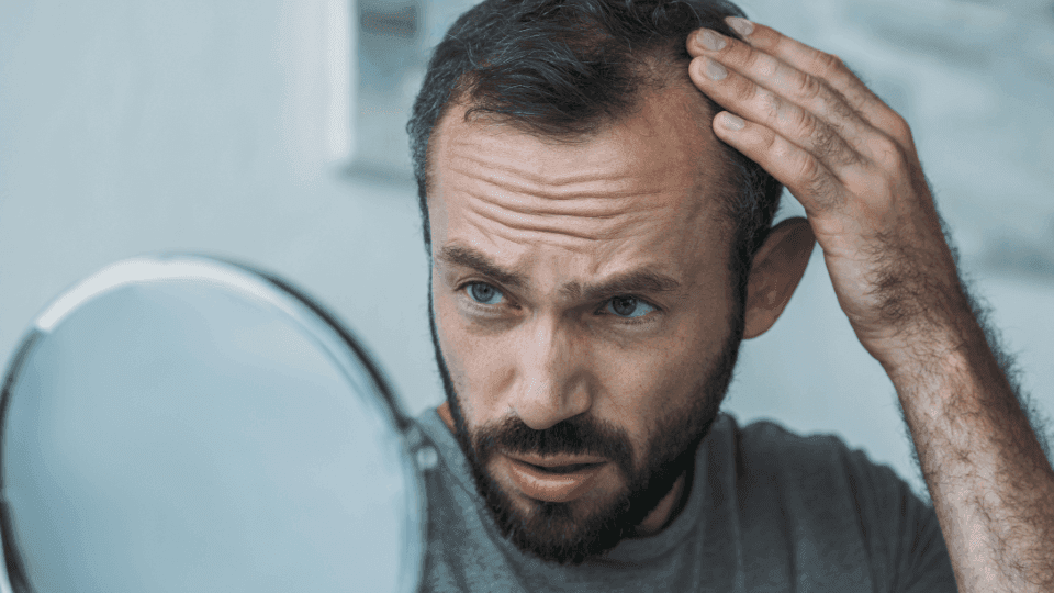 Kapan Sebaiknya Harus Melakukan Tanam Rambut?