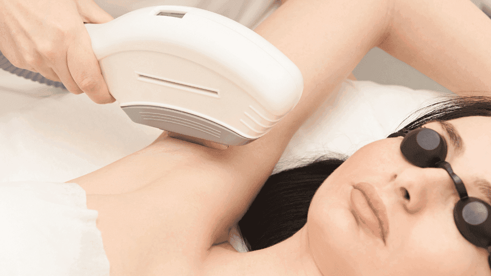 Apa Itu IPL Hair Removal Ini Manfaat dan Cara Kerjanya