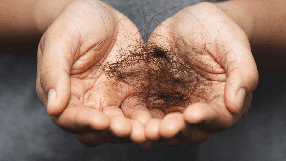 Manfaat Kelebihan dan Kekurangan Obat Penumbuh Rambut Herbal dan Resep Dokter Mana yang Lebih Disarankan