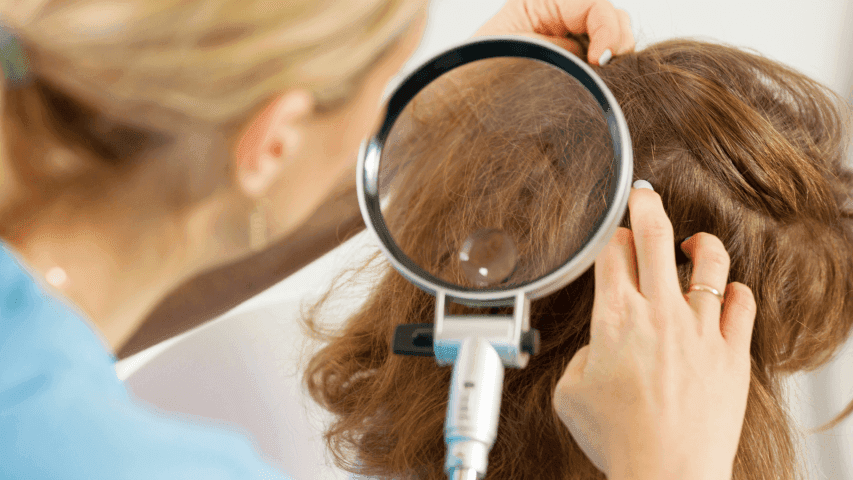 Basmi Kutu Rambut dan Telurnya Diricare