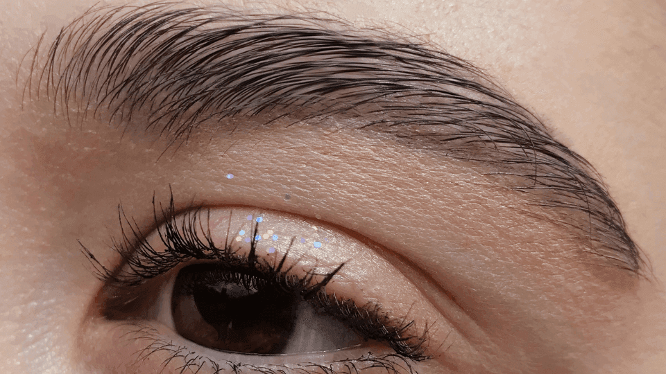 penyebab ketombe di alis