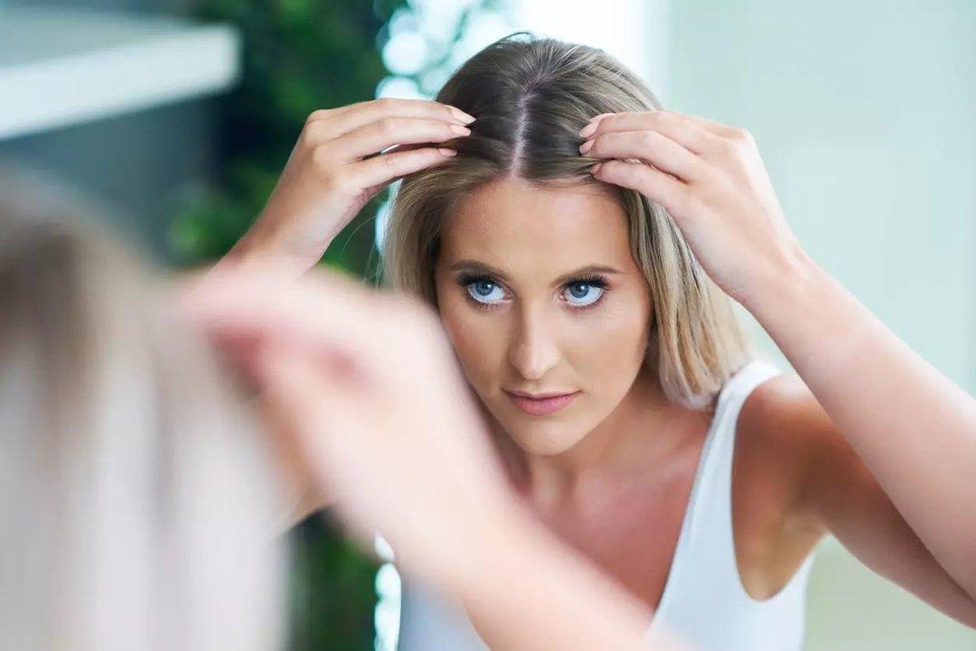 Gejala dan Cara Mengobati Dermatitis Seboroik Ketombe Diricare